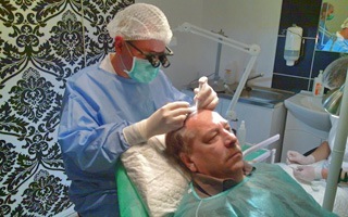 Przeszczep włosów w PHAEYDE Clinic na Węgrzech